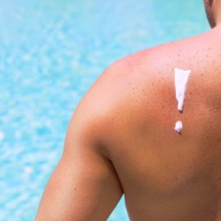 SPREČITE SIMPTOME ALERGIJE NA SUNCE